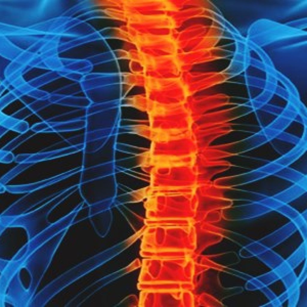 siemens healthineers nuvasive spine surgery